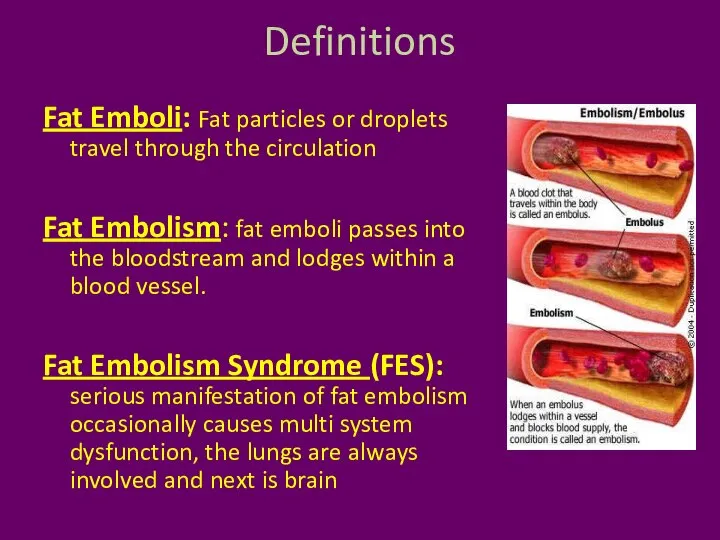 Definitions Fat Emboli: Fat particles or droplets travel through the circulation Fat