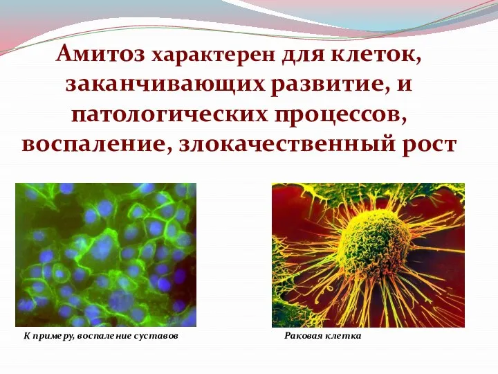 Амитоз характерен для клеток, заканчивающих развитие, и патологических процессов, воспаление, злокачественный рост