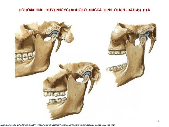 ПОЛОЖЕНИЕ ВНУТРИСУСТАВНОГО ДИСКА ПРИ ОТКРЫВАНИЯ РТА Цехмистренко Т.А. Занятие ДОТ «Соединения костей