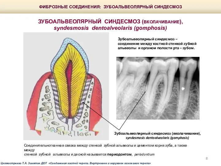 ФИБРОЗНЫЕ СОЕДИНЕНИЯ: ЗУБОАЛЬВЕОЛЯРНЫЙ СИНДЕСМОЗ ЗУБОАЛЬВЕОЛЯРНЫЙ СИНДЕСМОЗ (ВКОЛАЧИВАНИЕ), syndesmosis dentoalveolaris (gomphosis) Зубоальвеолярный синдесмоз