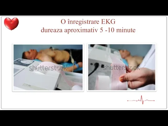 O înregistrare EKG dureaza aproximativ 5 -10 minute