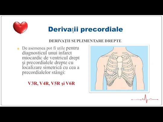 Derivaţii precordiale DERIVAŢII SUPLIMENTARE DREPTE De asemenea pot fi utile pentru diagnosticul