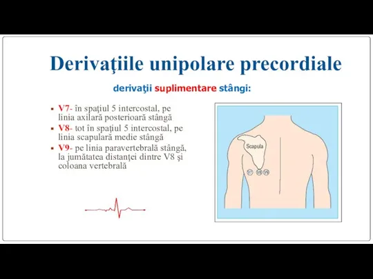 Derivaţiile unipolare precordiale derivaţii suplimentare stângi: V7- în spaţiul 5 intercostal, pe