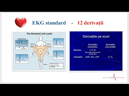 EKG standard - 12 derivaţii