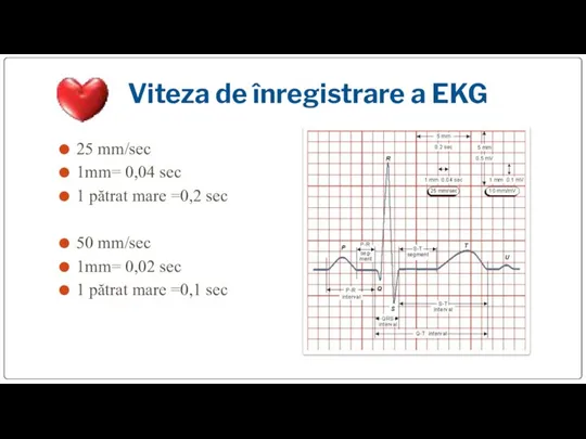 Viteza de înregistrare a EKG 25 mm/sec 1mm= 0,04 sec 1 pătrat