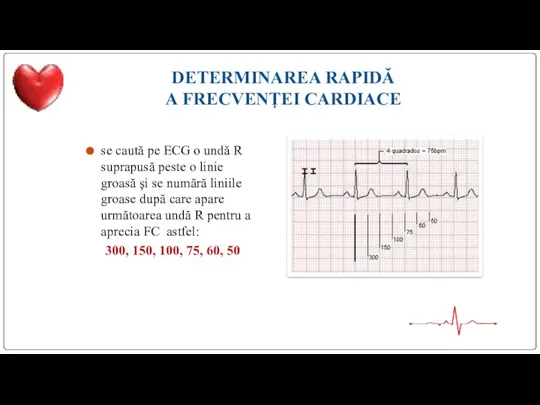 DETERMINAREA RAPIDĂ A FRECVENŢEI CARDIACE se caută pe ECG o undă R