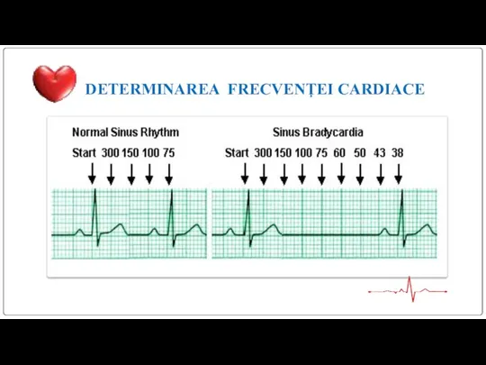 DETERMINAREA FRECVENŢEI CARDIACE