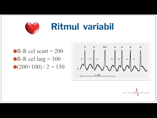 Ritmul variabil R-R cel scurt = 200 R-R cel larg = 100