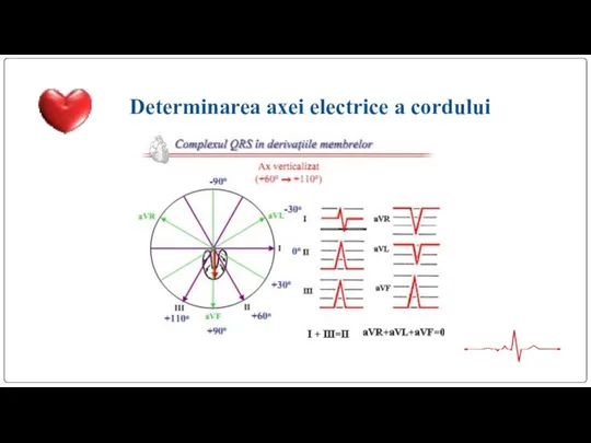 Determinarea axei electrice a cordului