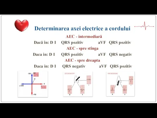 Determinarea axei electrice a cordului DAEC - intermediară Dacă în: D I