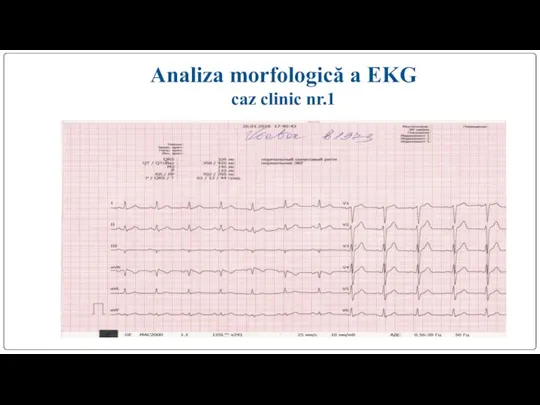 Analiza morfologică a EKG caz clinic nr.1