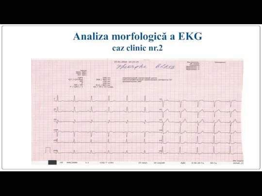 Analiza morfologică a EKG caz clinic nr.2