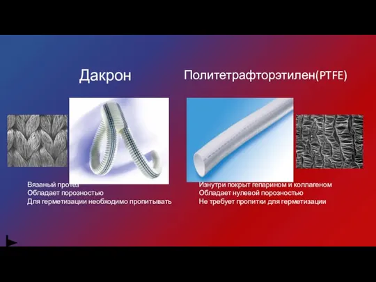 Дакрон Политетрафторэтилен(PTFE) Вязаный протез Обладает порозностью Для герметизации необходимо пропитывать Изнутри покрыт