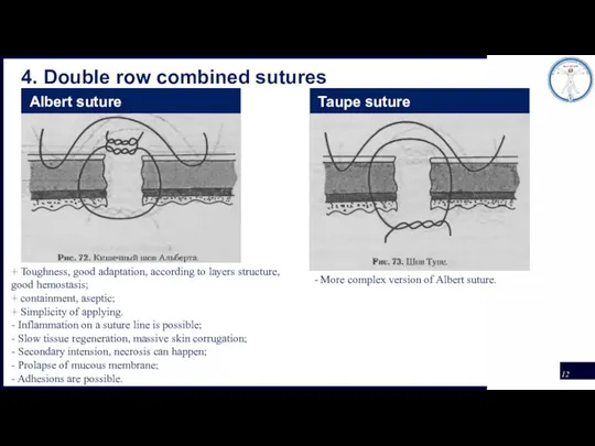 4. Double row combined sutures Albert suture Taupe suture + Toughness, good