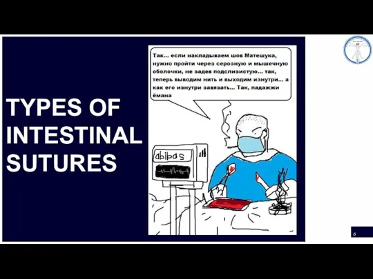 TYPES OF INTESTINAL SUTURES