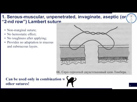 1. Serous-muscular, unpenetrated, invaginate, aseptic (or “2-nd row”) Lambert suture Can be