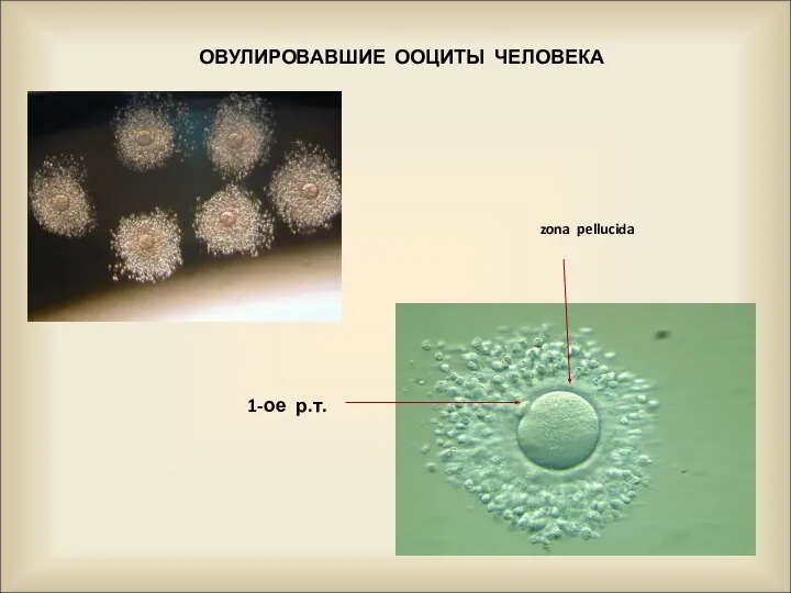 ОВУЛИРОВАВШИЕ ООЦИТЫ ЧЕЛОВЕКА 1-ое р.т. zona pellucida