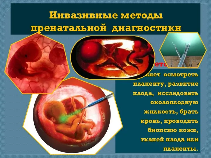 Фетоскопия позволяет осмотреть плаценту, развитие плода, исследовать околоплодную жидкость, брать кровь, проводить