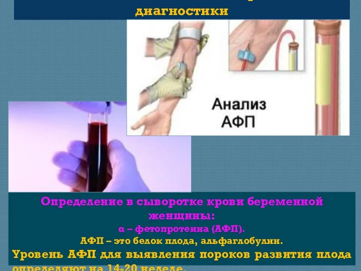 Неинвазивные методы дородовой диагностики Определение в сыворотке крови беременной женщины: α –