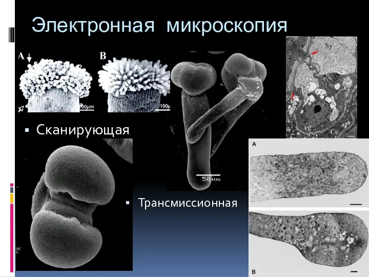 Электронная микроскопия Сканирующая Трансмиссионная