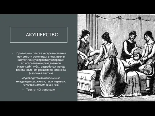 АКУШЕРСТВО Проводил и описал кесарево сечение при смерти роженицы, вновь ввел в