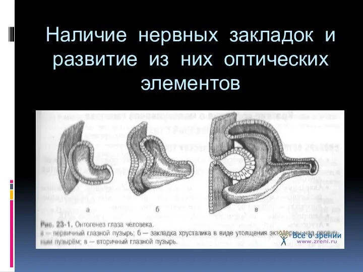 Наличие нервных закладок и развитие из них оптических элементов