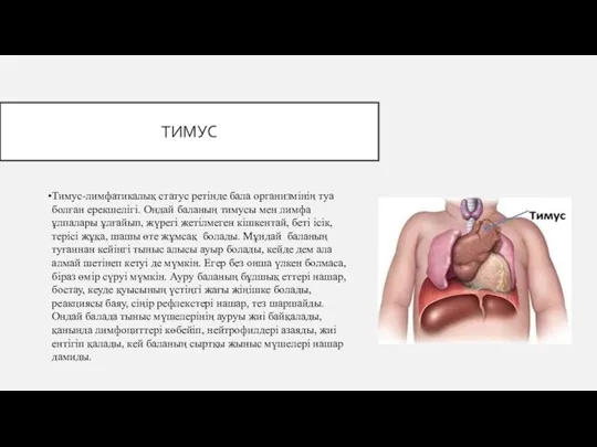 ТИМУС Тимус-лимфатикалық статус ретінде бала организмінің туа болған ерекшелігі. Ондай баланың тимусы