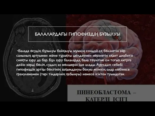 БАЛАЛАРДАҒЫ ГИПОФИЗДІҢ БҰЗЫЛУЫ Балада өсудің бұзылуы байқалуы мүмкін; сондай-ақ бөлінетін зәр санының