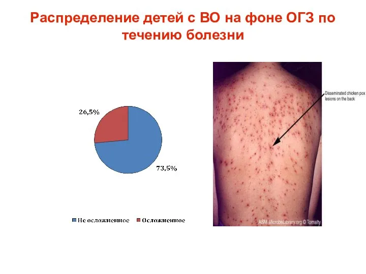 Распределение детей с ВО на фоне ОГЗ по течению болезни