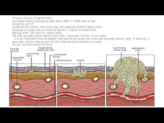 This is a picture of cancer cells. Our body make a cancerous