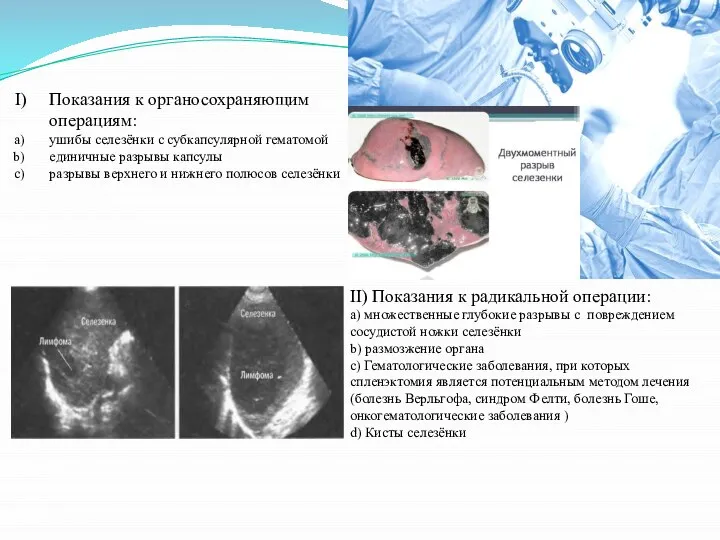 Показания к органосохраняющим операциям: ушибы селезёнки с субкапсулярной гематомой единичные разрывы капсулы