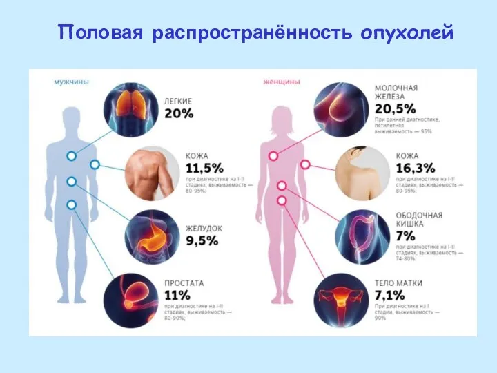 Половая распространённость опухолей