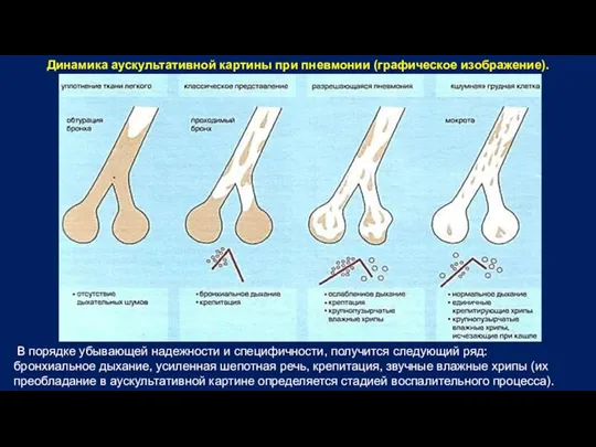 Динамика аускультативной картины при пневмонии (графическое изображение). В порядке убывающей надежности и