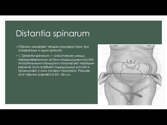 Distantia spinarum Обычно измеряют четыре размера таза: три поперечных и один прямой.