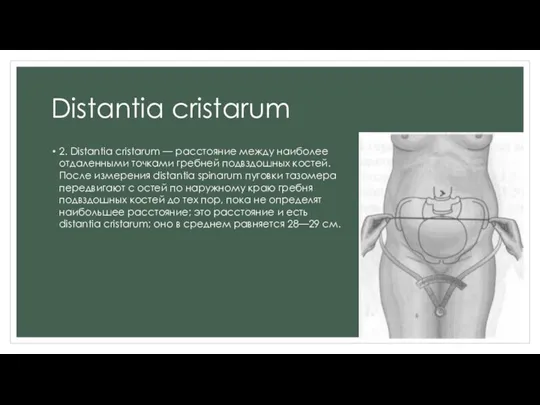 Distantia cristarum 2. Distantia cristarum — расстояние между наиболее отдаленными точками гребней