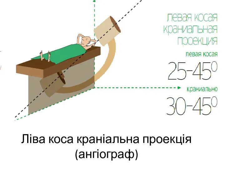 Ліва коса краніальна проекція (ангіограф)