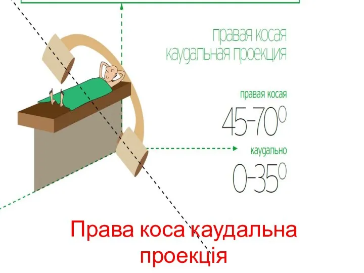 Права коса каудальна проекція