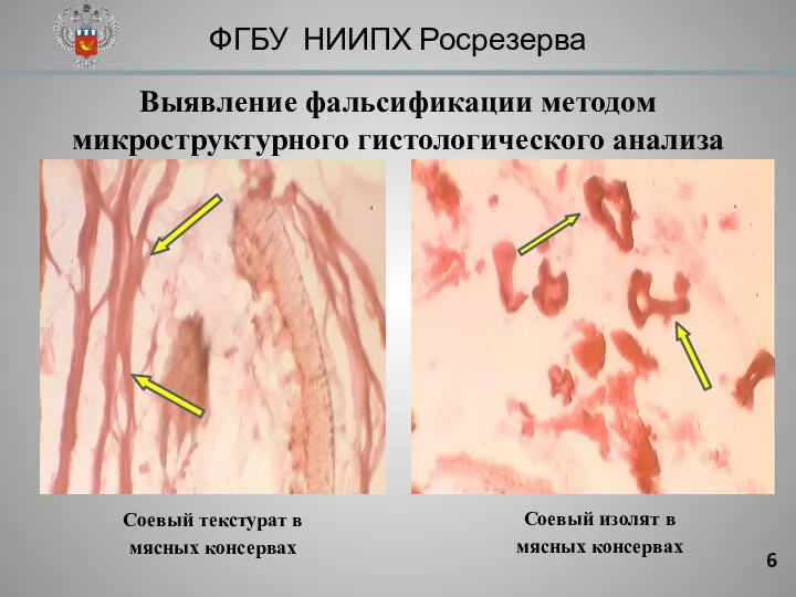 ФГБУ НИИПХ Росрезерва Выявление фальсификации методом микроструктурного гистологического анализа Соевый текстурат в