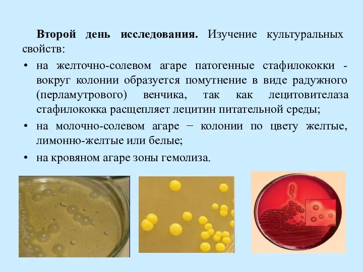 Второй день исследования. Изучение культуральных свойств: на желточно-солевом агаре патогенные стафилококки -