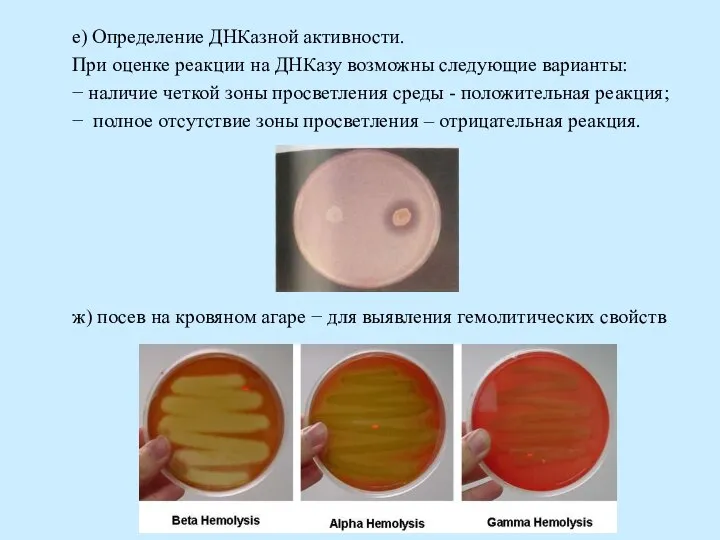 е) Определение ДНКазной активности. При оценке реакции на ДНКазу возможны следующие варианты: