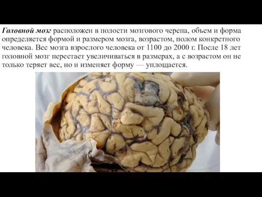 Головной мозг расположен в полости мозгового черепа, объем и форма определяется формой