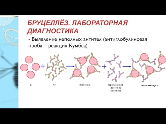 БРУЦЕЛЛЁЗ. ЛАБОРАТОРНАЯ ДИАГНОСТИКА - Выявление неполных антител (антиглобулиновая проба – реакция Кумбса)