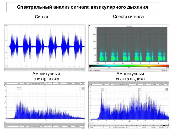 Спектральный анализ сигнала везикулярного дыхания 9(10) Сигнал Спектр сигнала Амплитудный спектр вдоха Амплитудный спектр выдоха