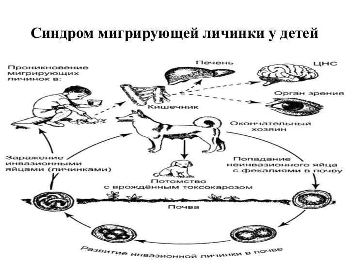 Синдром мигрирующей личинки у детей