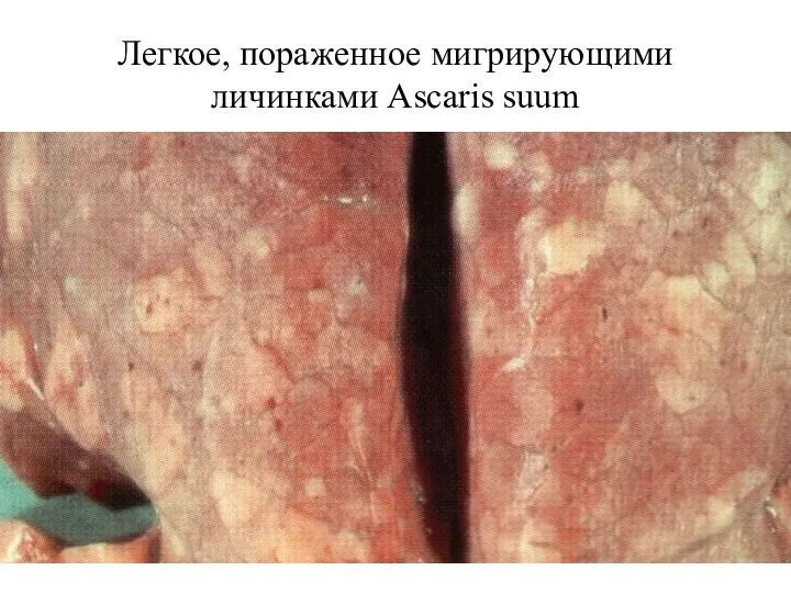 Легкое, пораженное мигрирующими личинками Ascaris suum