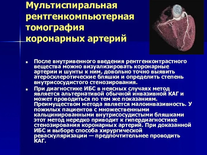 Мультиспиральная рентгенкомпьютерная томография коронарных артерий После внутривенного введения рентгенконтрастного вещества можно визуализировать