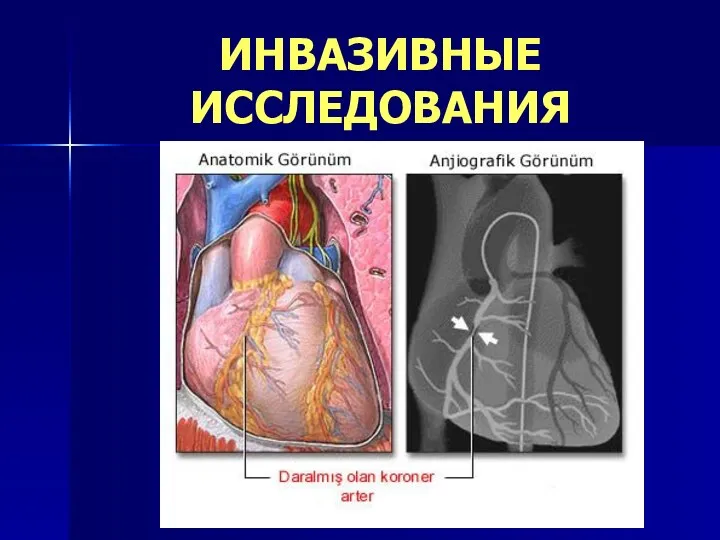 ИНВАЗИВНЫЕ ИССЛЕДОВАНИЯ