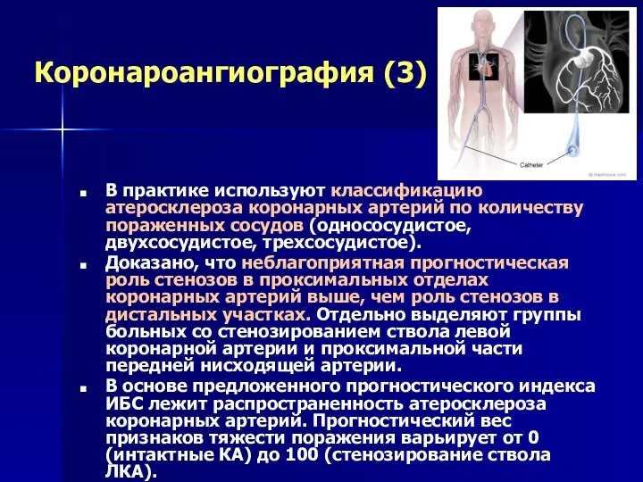 Коронароангиография (3) В практике используют классификацию атеросклероза коронарных артерий по количеству пораженных