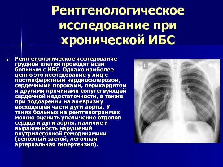 Рентгенологическое исследование при хронической ИБС Рентгенологическое исследование грудной клетки проводят всем больным