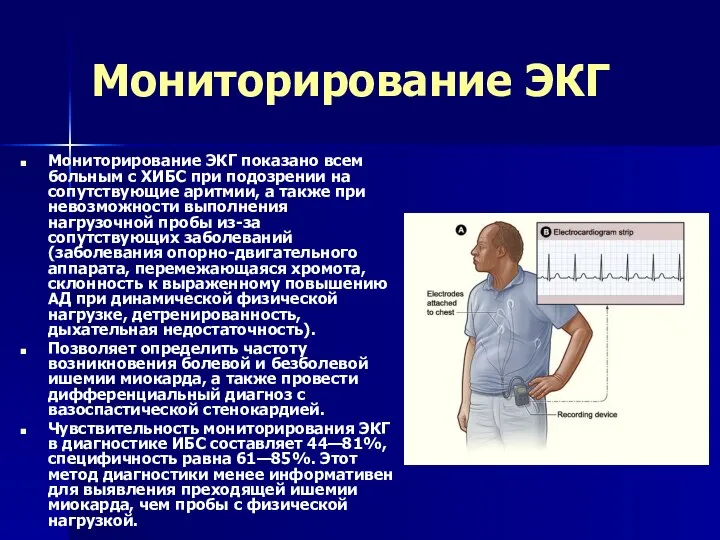 Мониторирование ЭКГ Мониторирование ЭКГ показано всем больным с ХИБС при подозрении на